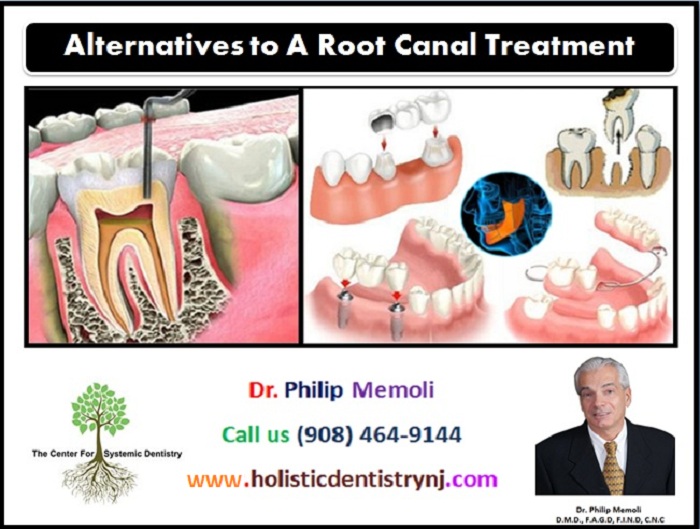 Dr-Philip-Memoli-Root-Canal-Alternative-Treatments.jpg
